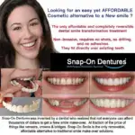 Adjustable Snap-On Dentures - Image 3