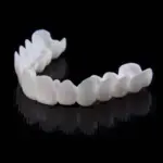 Adjustable Snap-On Dentures - Image 6